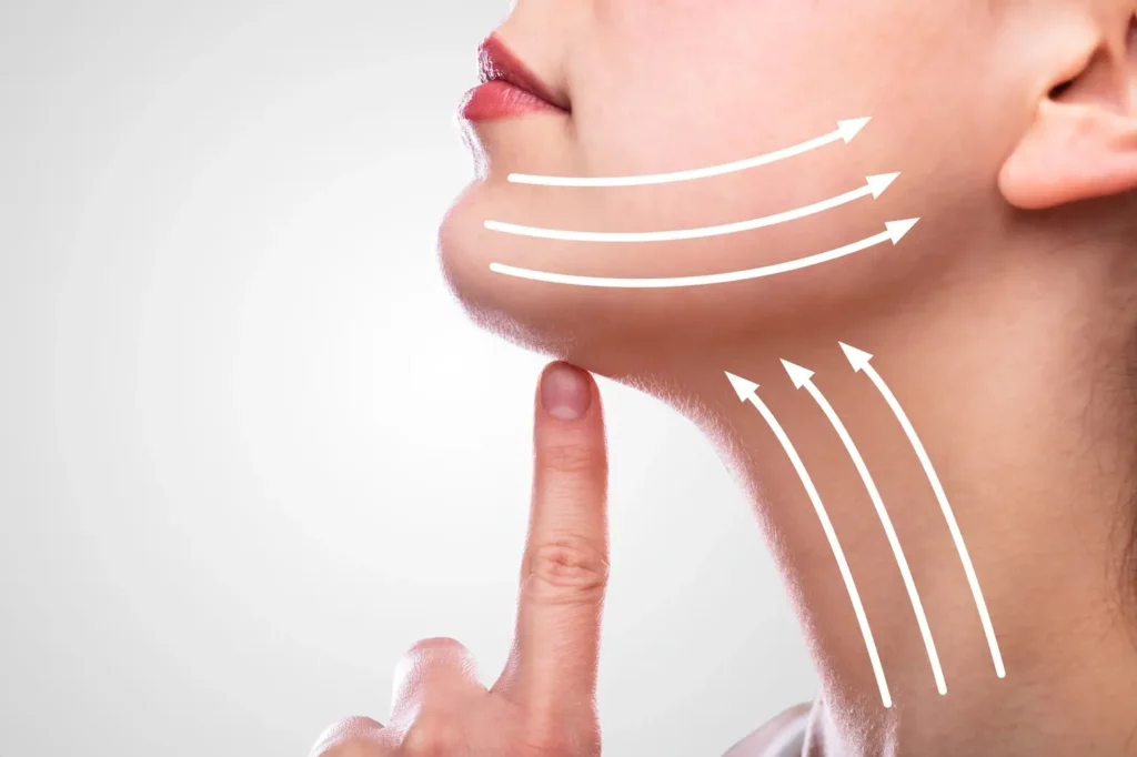 clearlift service by grand valley laser aesthetics in grand junction, co