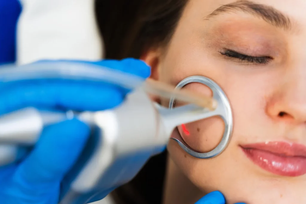co2 img service grand valley laser aesthetics in grand junction co
