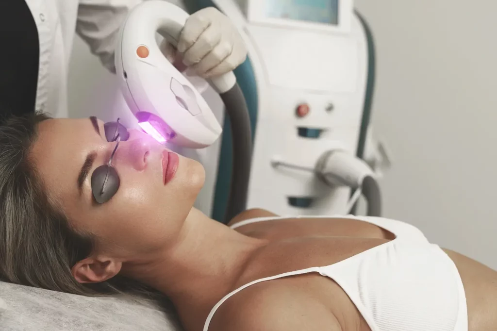 DYE-VL Service at Grand Valley Laser Aesthetics in grand junction, CO