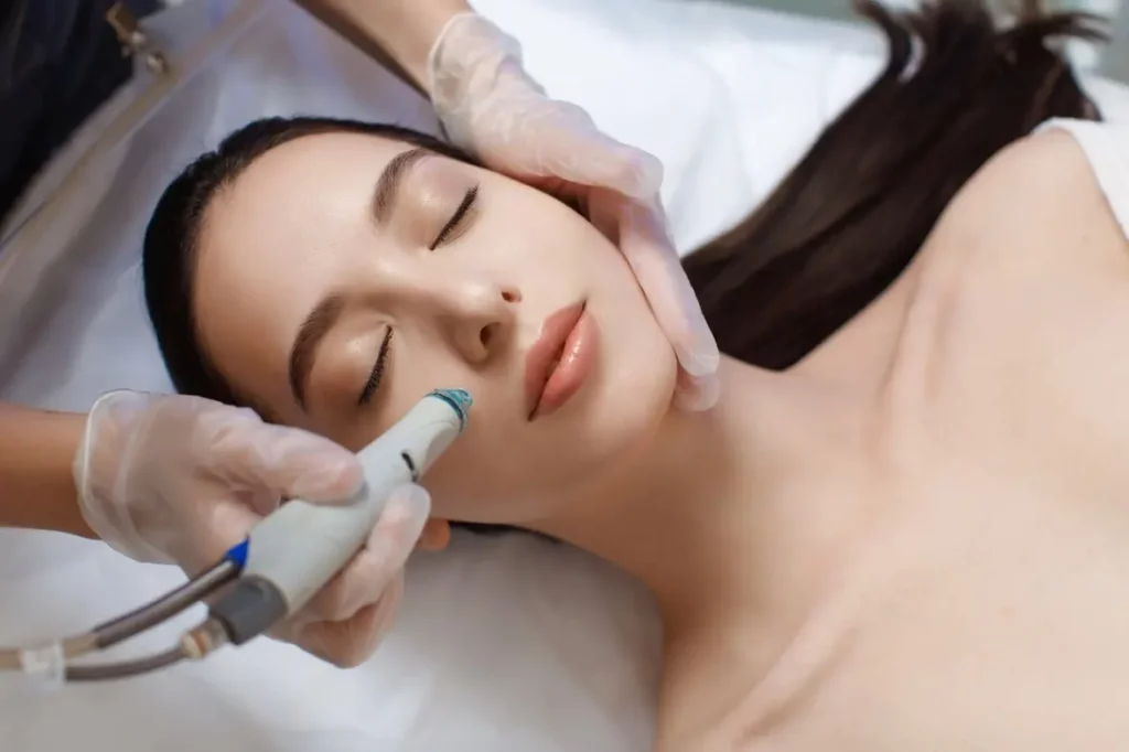 microneedling service by grand valley laser aesthetics in grand junction, co
