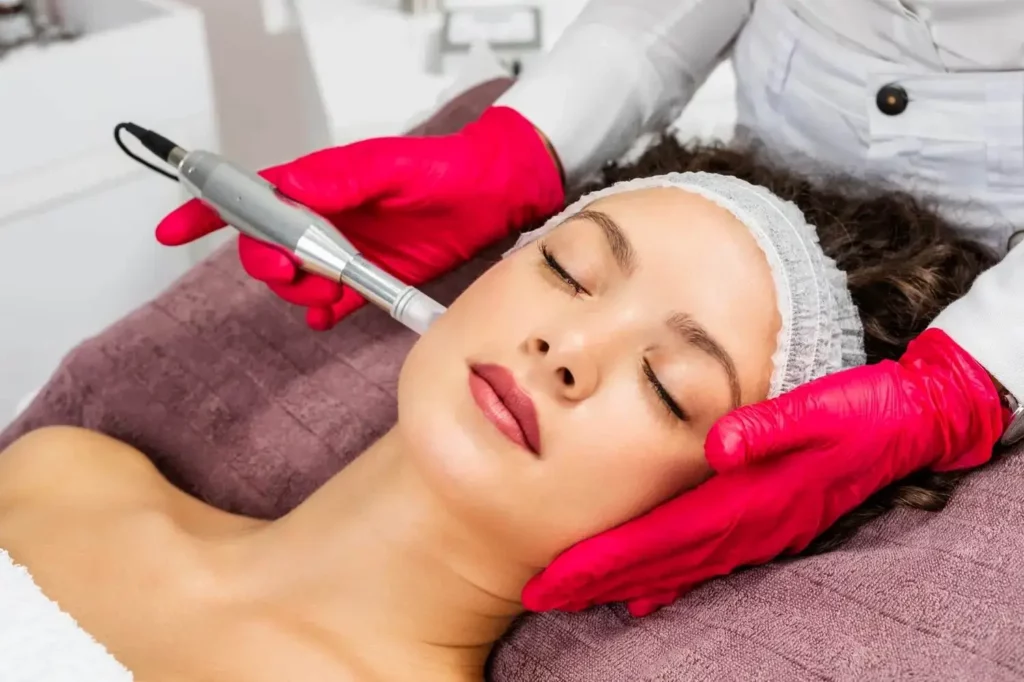 PRP Microneedling Service by Grand Valley Laser Aesthetics in Grand Junction, CO