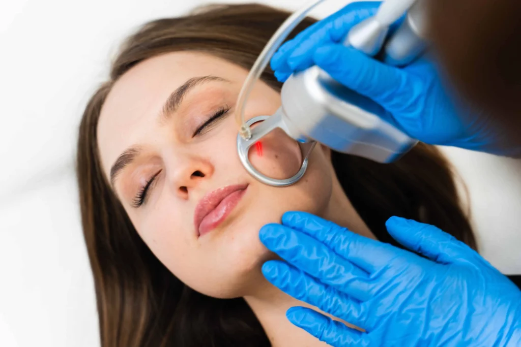 CO2 Laser Treatment
